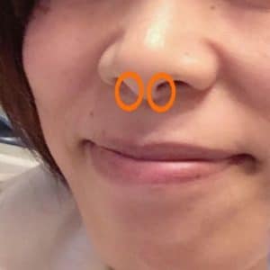 鼻ワセリン